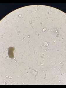 犬の糞便検査により検出されたジアルジア①