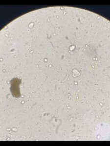 犬の糞便検査により検出されたジアルジア②