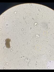 犬の糞便検査により検出されたジアルジア③