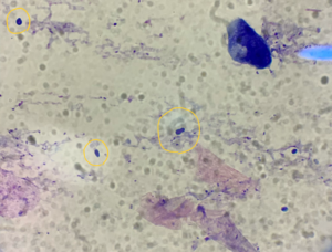 顕微鏡で検出されたマラセチア